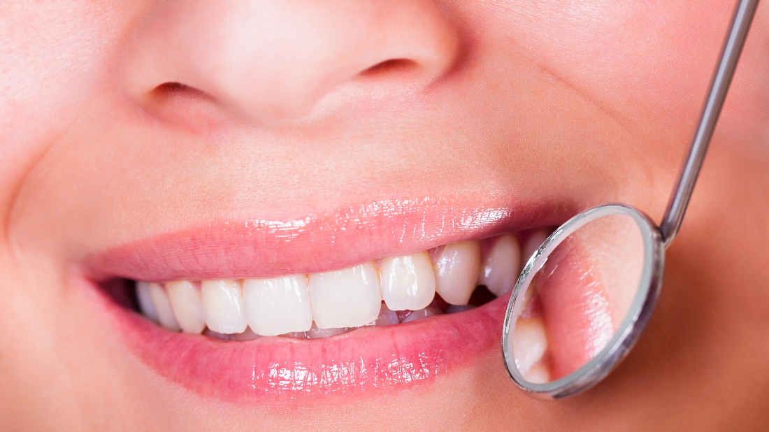 Dental Filling Procedure Springfield General Dentistry Blog