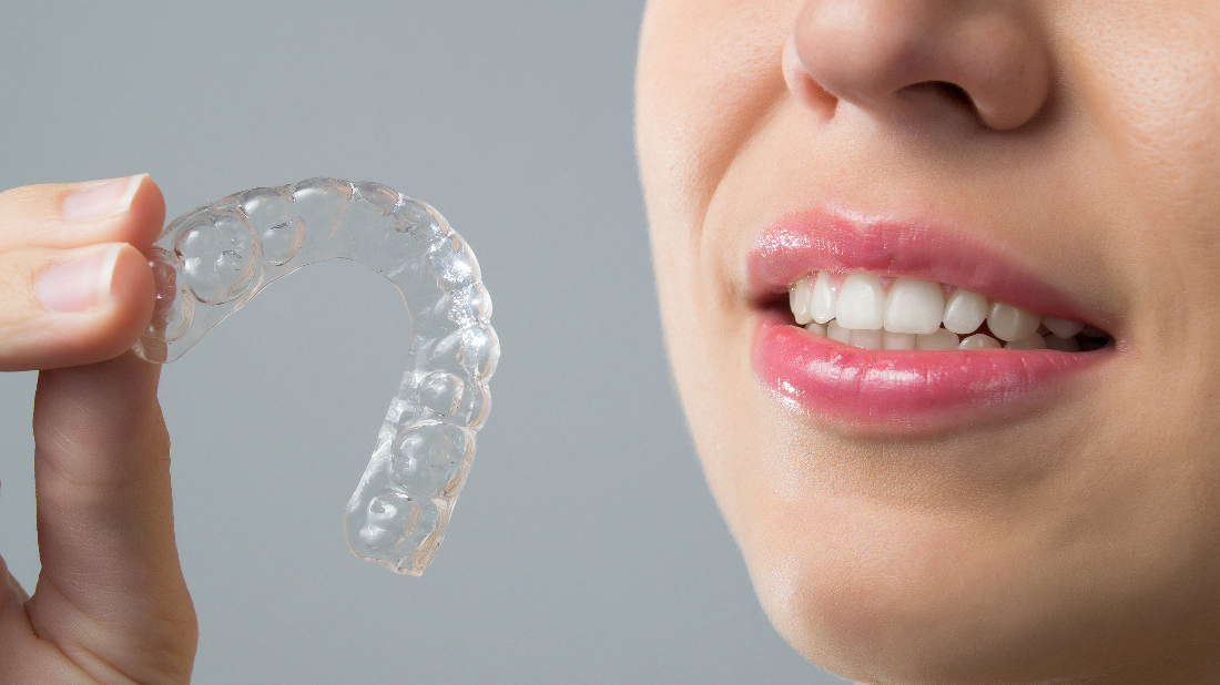 Dentist Springfield IL Keeping Your Retainer Clean