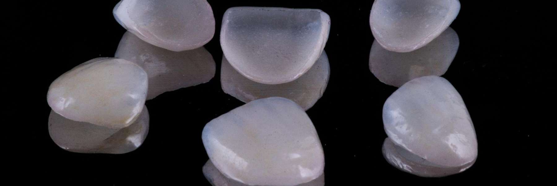 Veneers in Springfield, IL