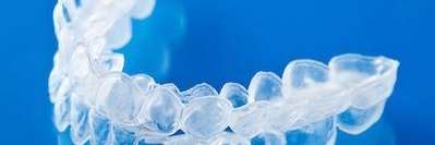 Invisalign in Springfield, IL