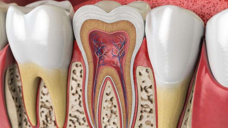 Root Canal Illustration