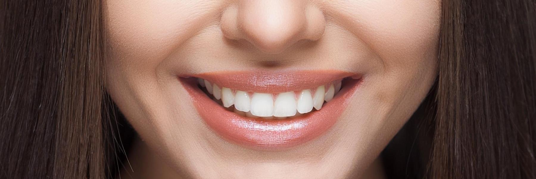 Close up of results from teeth whitening in Springfield IL